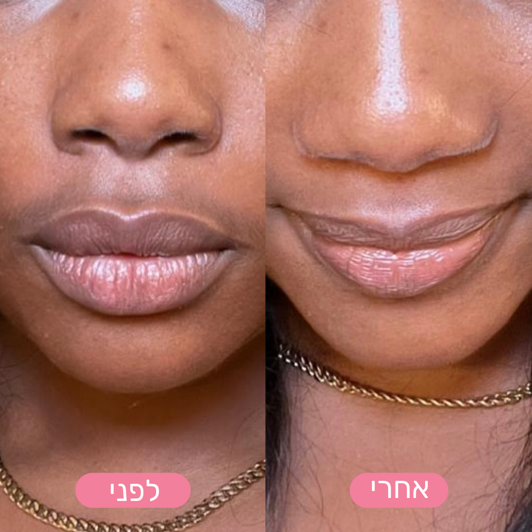 MiGlow - הסרת שיער פנים עדינה ובטוחה לעור רגיש