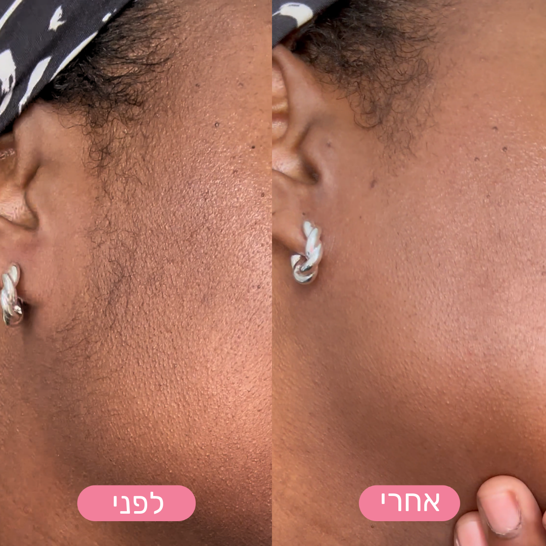 MiGlow - הסרת שיער פנים עדינה ובטוחה לעור רגיש